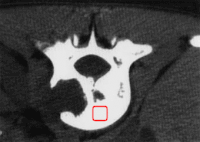Segmentation Example 2